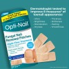 Dos Pegatinas Renovadoras De Uñas Para Hongos Opti-nail 21