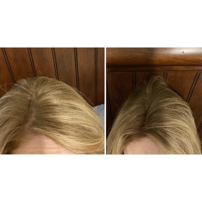 Caboki Value Pack 4, 360-Day Supply (Golden Blonde)