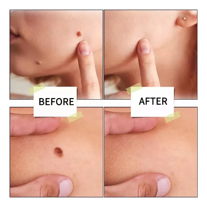 Crema For El Tratamiento De La Piel Dp 2 Piezas