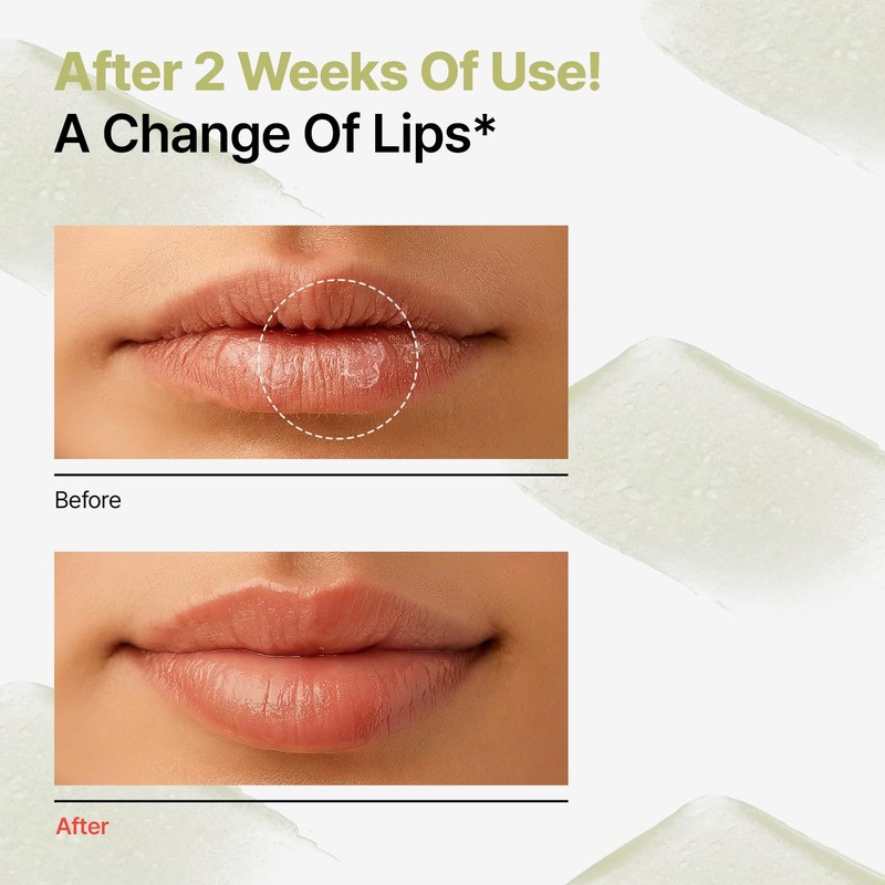 Dr.Different Retinal Lip Balm Clear, Anti-Wrinkle Lip Treatment with Deep