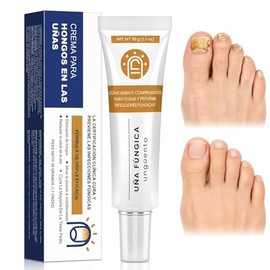 Crema para el Cuidado de las Uñas,Pomada Reparadora de Uñas,Restaura Uñas Dañadas,ingredientes naturales,Fortalece las Uñas,Mejorar el color de las uñ