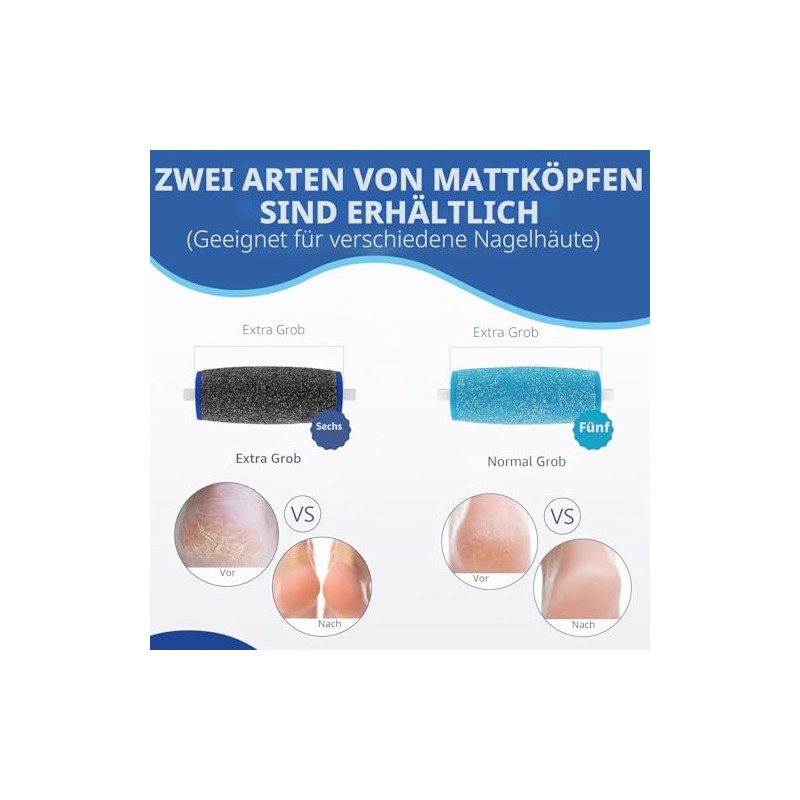Pack of 11 Callus Remover Replacement Rollers, Includes 6 Extra