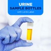 15 Urine Sample Bottles Specimen Pot Graduated Container with Lid
