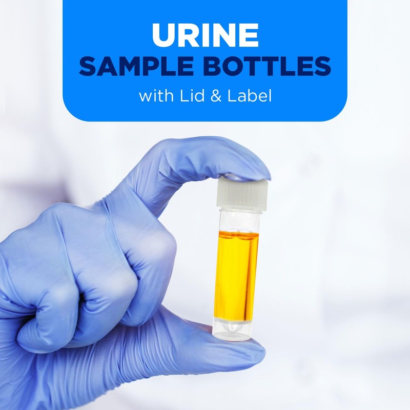 15 Urine Sample Bottles Specimen Pot Graduated Container with Lid