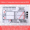 ECG 7 Step Ruler, ECG/EKG 7 Step Ruler Card for