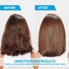CeraVe Anti Dandruff Hydrating Conditioner, Leaves Hair Soft, Nourished &