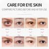 Under Eye Patches 50 Pads Collagen Eye Mask Sakura Gel
