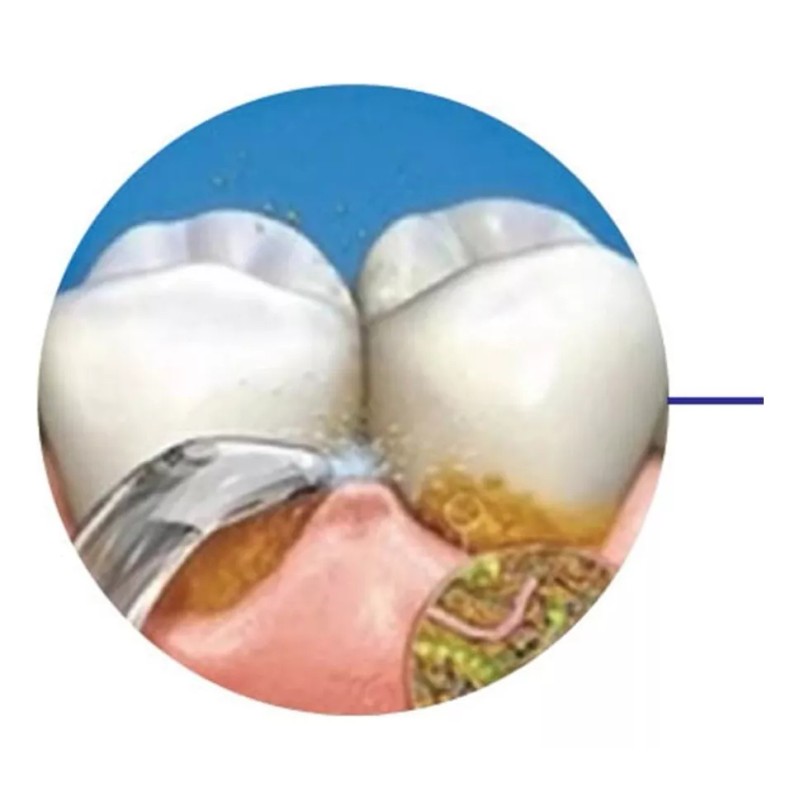 Vinfany Mango Con Boquilla Para Waterpik Oral Wp-450 Wp-250