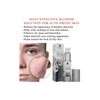 Blemish Spot Treatment Cream - Gentle Serum For Pimples,