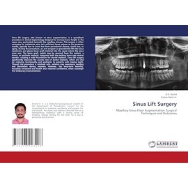 Sinus Lift Surgery: Maxillary Sinus Floor Augmentation: Surgical Techniques and Outcomes
