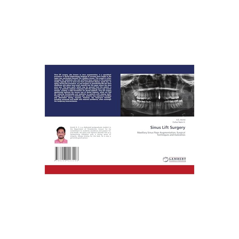 Sinus Lift Surgery: Maxillary Sinus Floor Augmentation: Surgical Techniques and