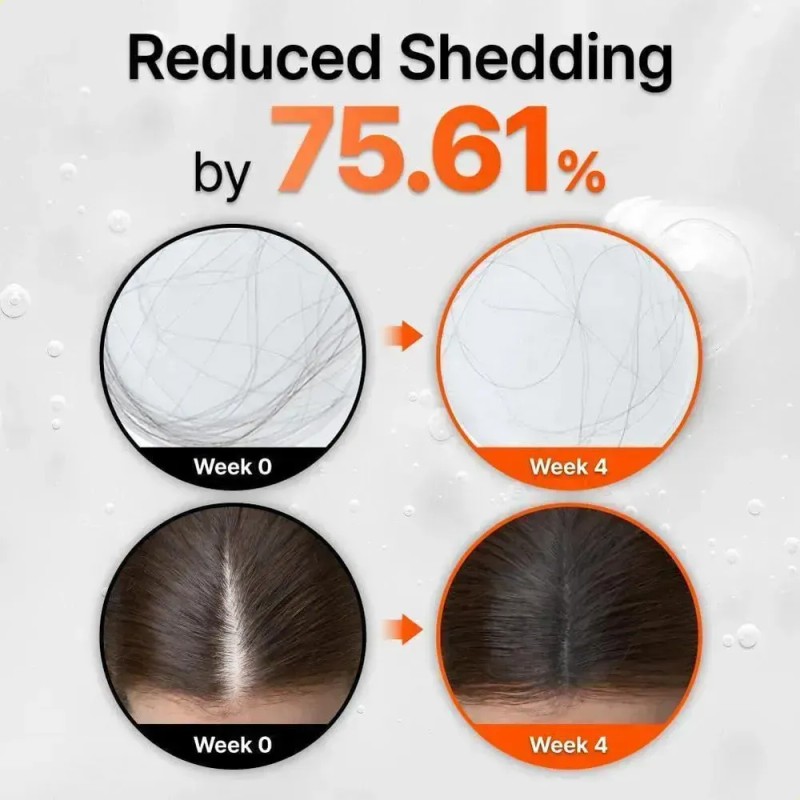 Lilyeve Hair Growth Serum With Brush