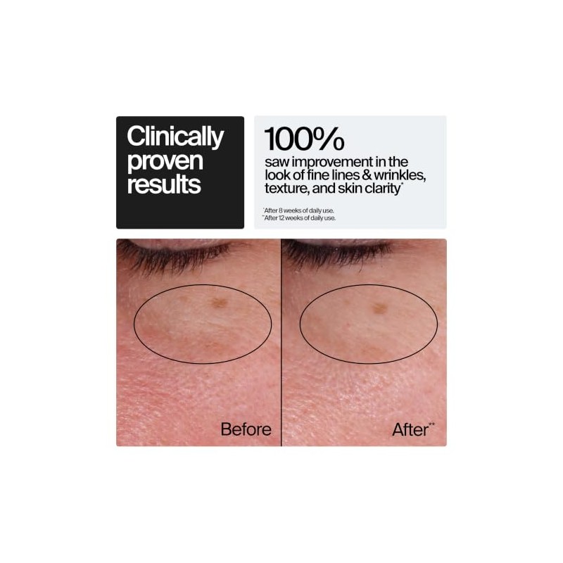Neutrogena, Crema Facial Antiarrugas Rapid Wrinkle Repair Retinol Sa 48