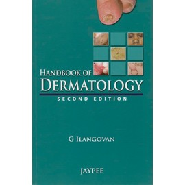 Handbook of Dermatology