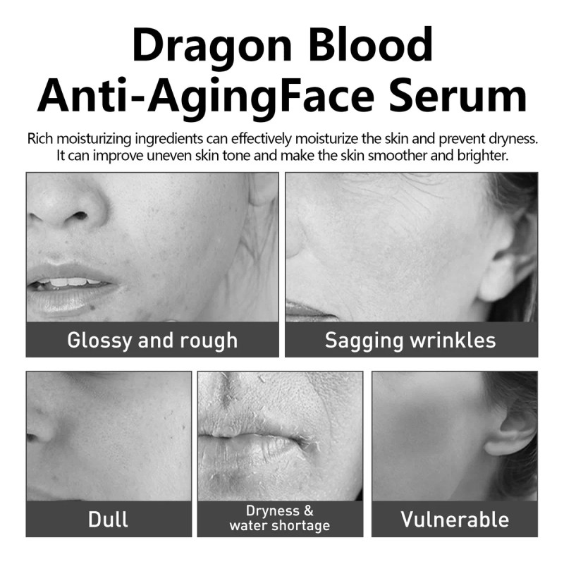 Esencia De Tratamiento Facial De Sangre Dragón Eelhoe 50ml