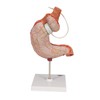 3B Scientific Human Anatomy - Stomach Band Model + Free