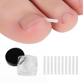 Ingrown Toenail Care Band Wire Tip 10p Fixed Toe Fixator Foot Ingrown Toenail Protection Ingrown toenail tip 10p 4ea