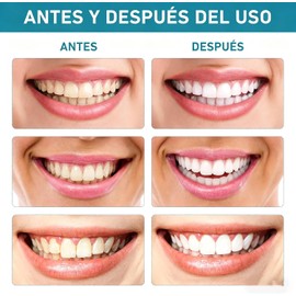 2pcs Colágeno En Polvo Para Dientes，Gum Colágeno En Polvo Para Dientes, Para El Cuidado Bucal Fortalecedor De La Sonrisa Con Colágeno E Hidroxiapatita,Refresca El Aliento, Fortalece Las Encías Y Protege Las Encías Y El Esmalte Dental