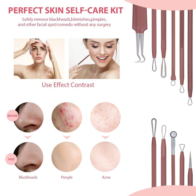 JPNK Blackhead Remover Tool Comedones Extractor Acne Removal Kit for