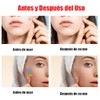 LUHI 200PCS Parches para Acne, Pimple Patch, Parches para Espinillas