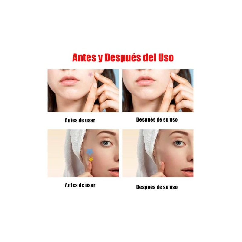 LUHI 200PCS Parches para Acne, Pimple Patch, Parches para Espinillas