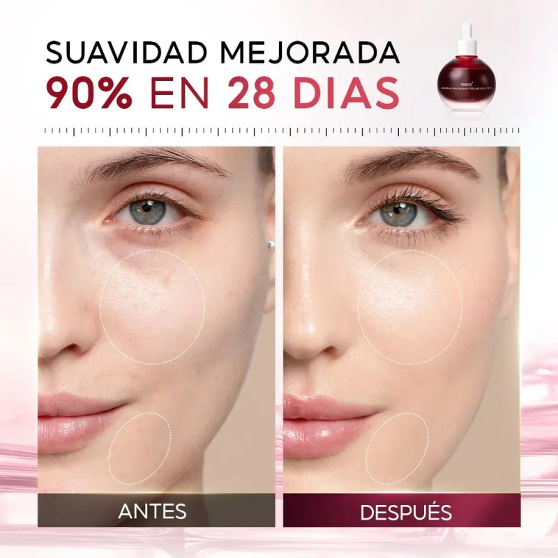 Papa Feel Serum Exfoliante Aha Bha Pha 30ml Con 5