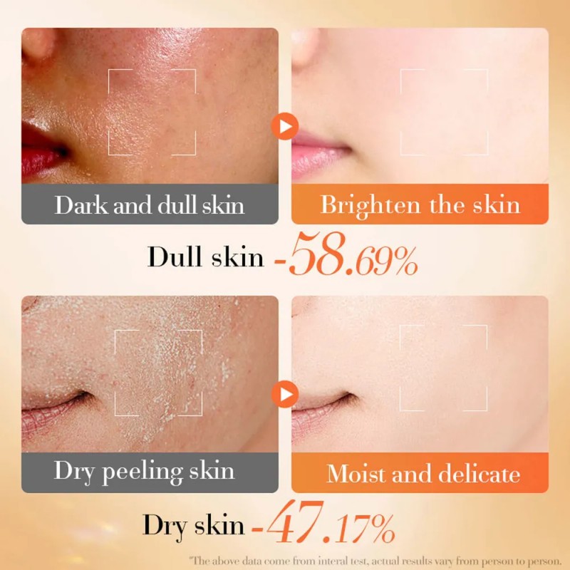 I Crema Facial Iluminadora Antioxidante