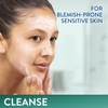 Cetaphil Gentle Clear Clarifying Blemish Cleanser 124ml, Face Wash for