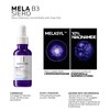 La Roche-Posay Mela B3 Duo: Anti-Fleckenserum 30 ml + Creme