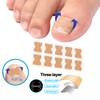 CHEMAILON Professional Ingrown Toenail Correction Kit - Stainless Steel Ingrown