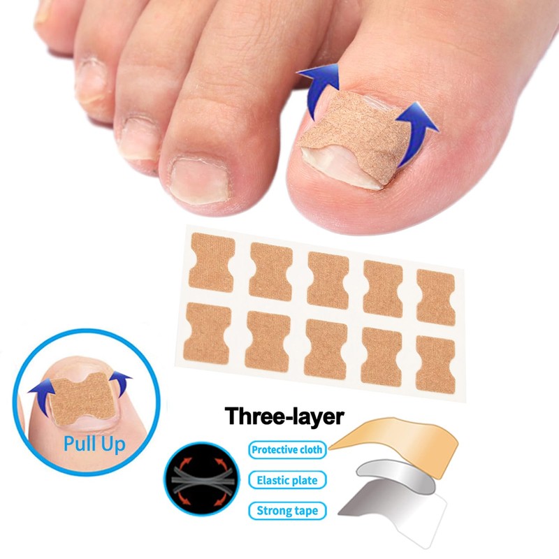 CHEMAILON Professional Ingrown Toenail Correction Kit - Stainless Steel Ingrown