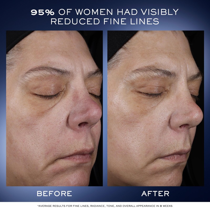 Lancome - Sérum Facial Lancôme Génifique Ultimate Dual Recovery 20