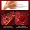 Varicose Veins Relief