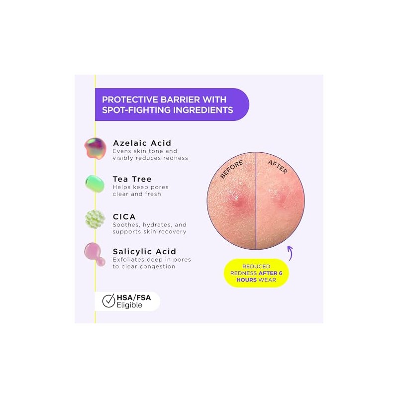ZitSticka Liquid Pimple Patch - Invisible Spot Treatment