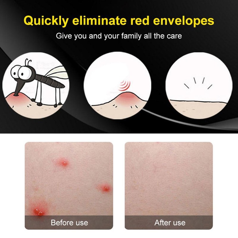 Antipruritic Stick Portable Mosquito Insect Bite Anti Itching Pen for