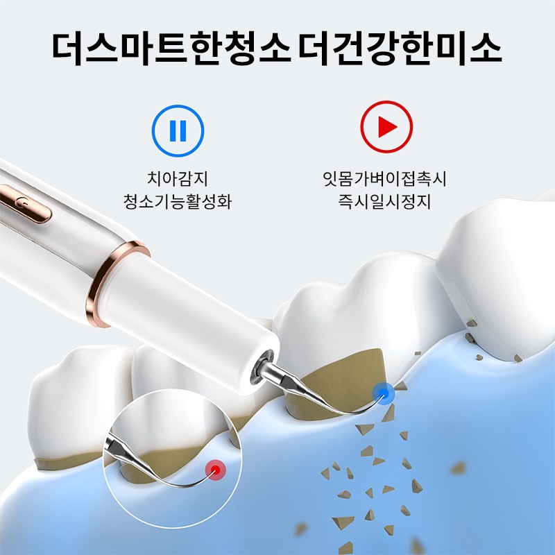 스마트 LED 초음파 치석제거기 셀프 스케일링 가정용 휴대용 Smart LED