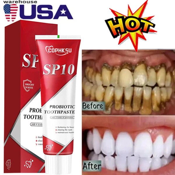 Unbranded Sp 10 Pasta Dental Sp-8 Ultra Whitening Sp10 Probiotic