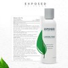 Acne Clearing Tonic Treatment Toner by Exposed Skin Care, Salicylic