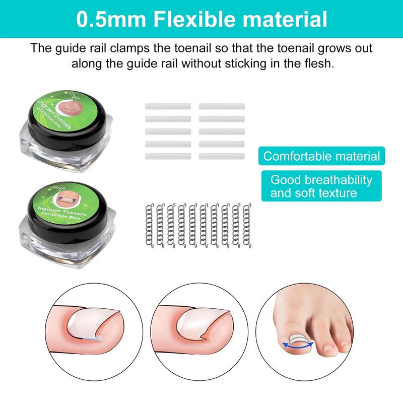 Ingrown Toenails Set Toenail Correction Patch Corrector Pedicure Stainless Steel