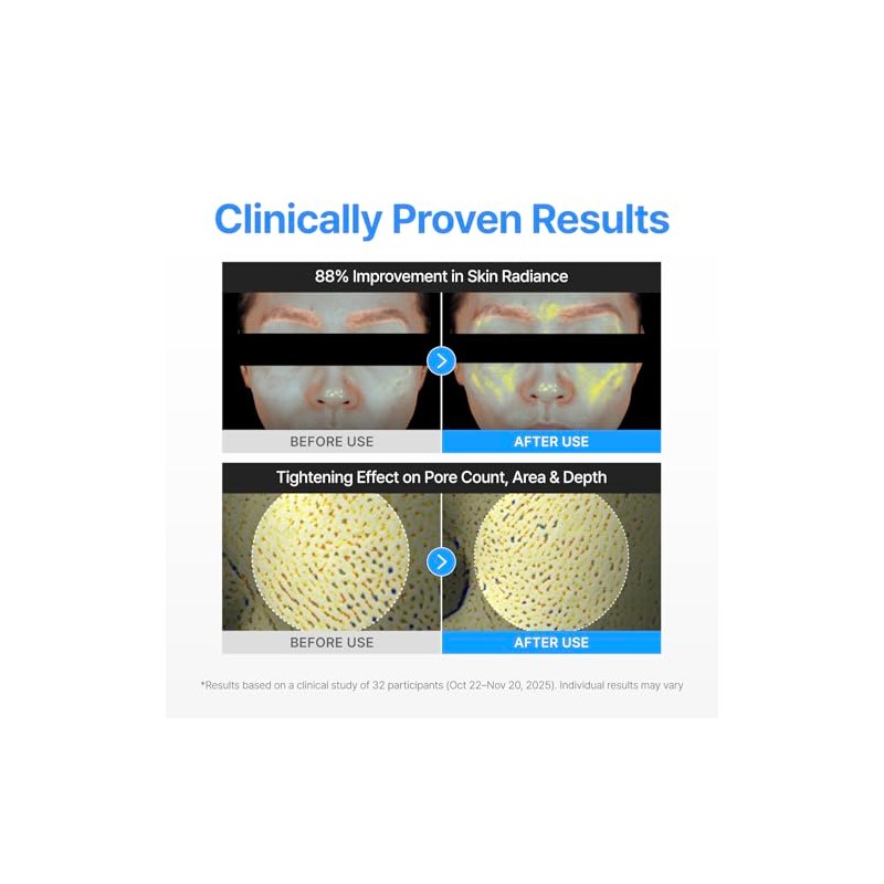 Centellian24 Madeca Derma Shield Vital Dewy Sunscreen, Protector Solar Híbrido,