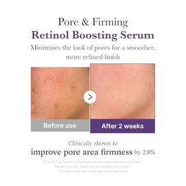 Medicube Retinol NMN Boosting Serum 1.9% Retinol-Some | 30 ml