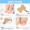 50 Pcs No Glue Breathable Corrector Patch,Painless ingrown toenail Corrector,Nail