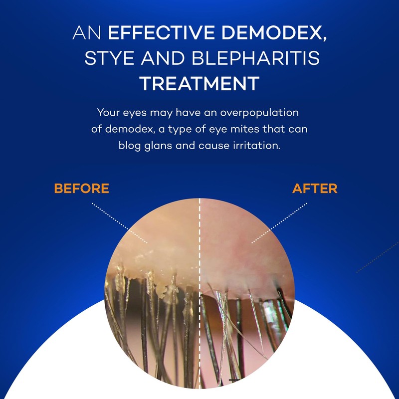 Zocular - Zocuwipe Eyelid Wipes with Natural Okra Complex -