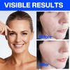 Anti-wrinkle plaster face tape face tape full face tightening