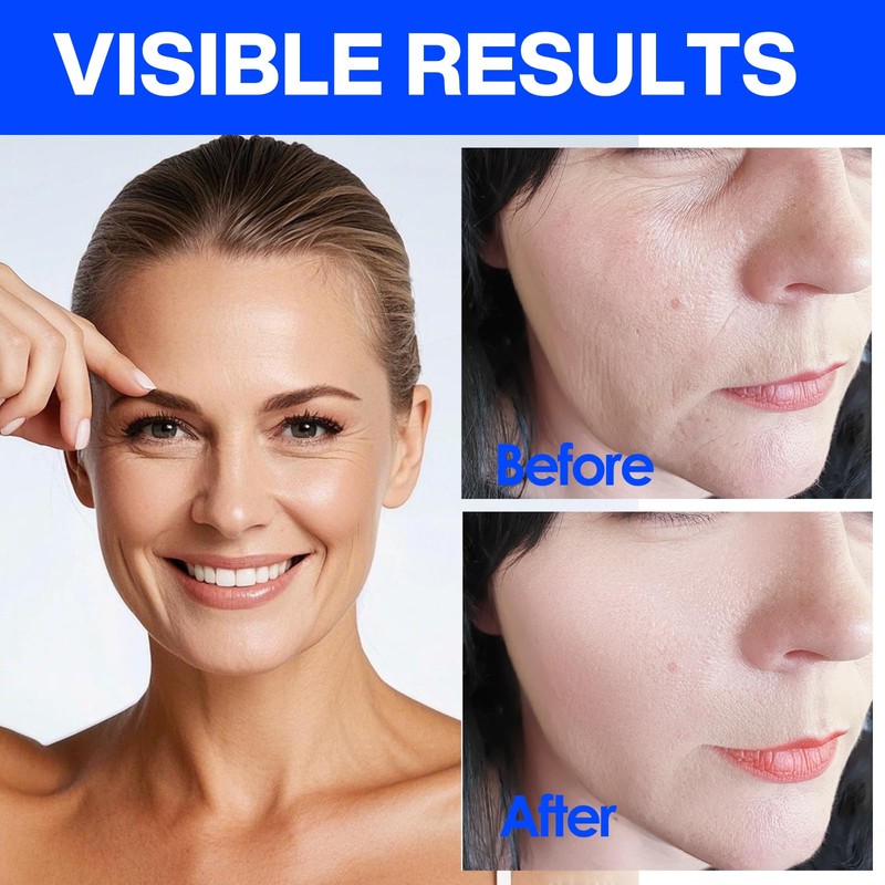 Anti-wrinkle plaster face tape face tape full face tightening