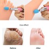 10pcs Sanding Caps with 1pcs Mandrel Handle Sanding Belts for
