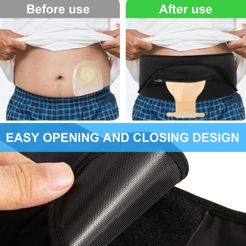 Ostomy Belt for Men & Women - Stealth Support Belt