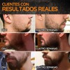 8 pz kit de crecimiento de barba, rodillo derma, bálsamo,