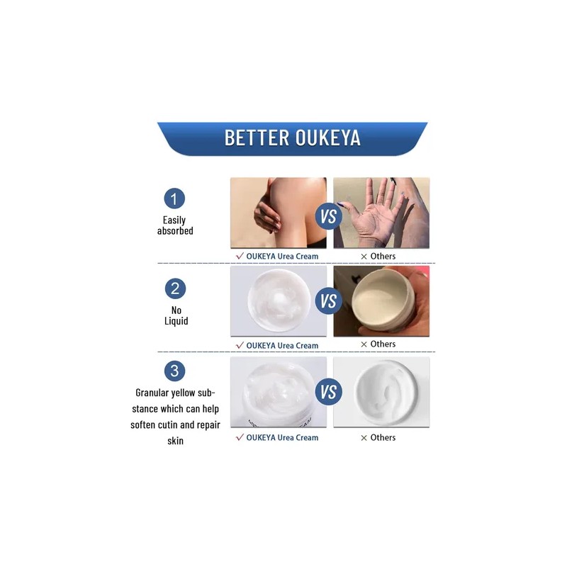 Crema For El Cuidado De Manos Y Pies, Crema Antigrietas,