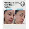 Kate Somerville EradiKate Daily Foaming Cleanser - Acne Face Wash
